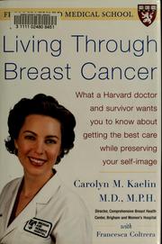 Living through breast cancer : what a Harvard doctor and survivor wants you to know about getting the best care while preserving your self-image  Cover Image