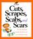 Go to record Cuts, scrapes, scabs, and scars