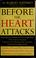 Go to record Before the heart attacks a revolutionary approach to detec...