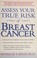 Go to record Assess your true risk of breast cancer